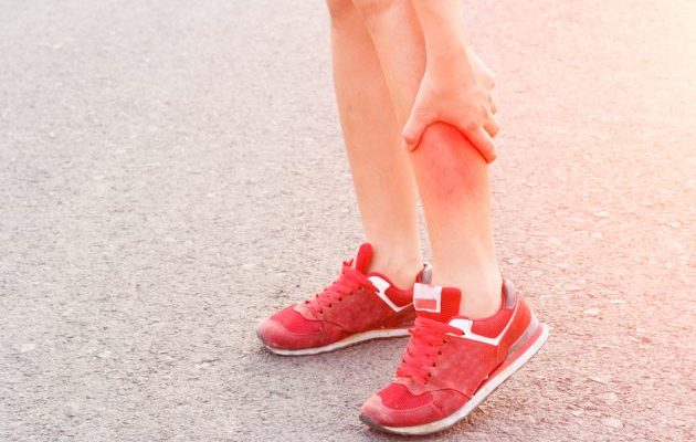 shin splints