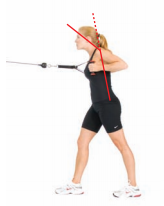forward head posture