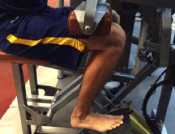 Calf (Baldır) Yırtığı ve Tedavisi